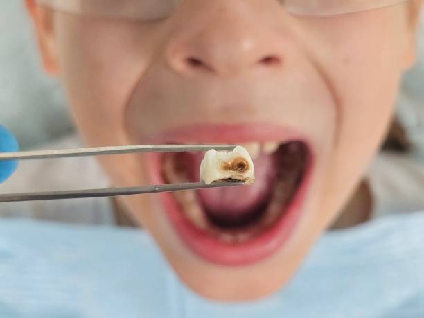 Best Weekend Emergency Dentist in Blue Jay, OH